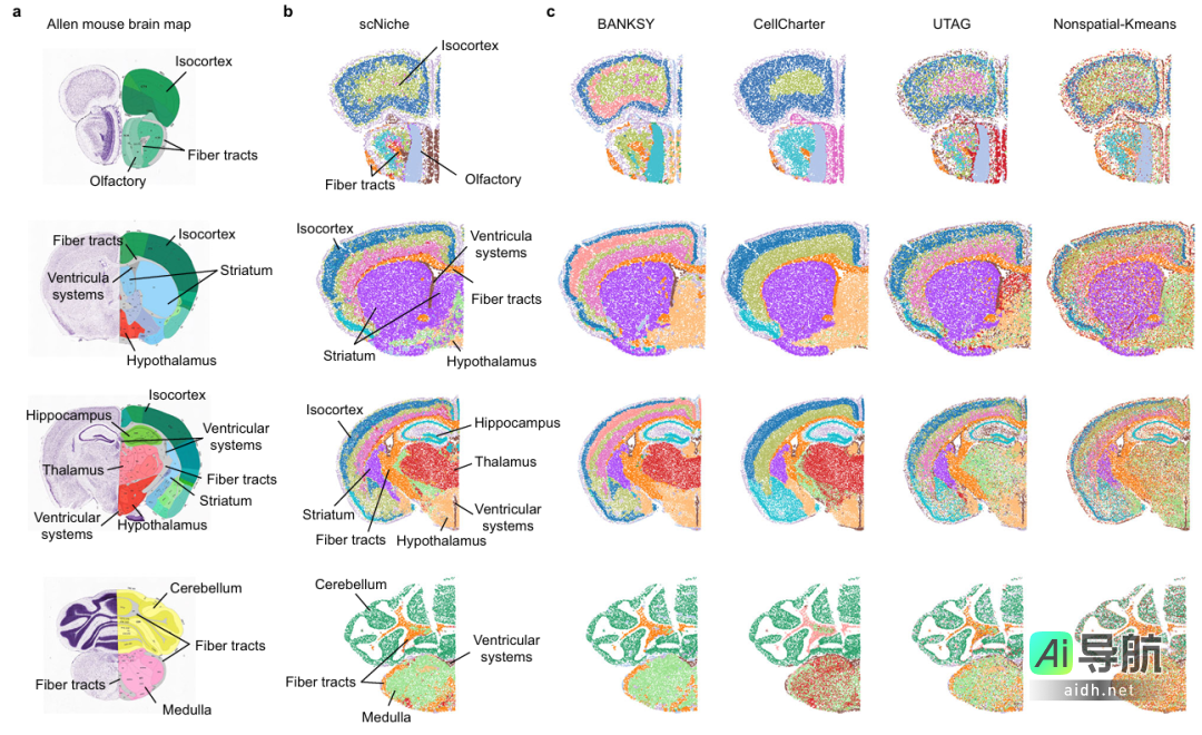浙大scNiche框架实现突破性进展，精准识别细胞生态位，推动精准医疗发展