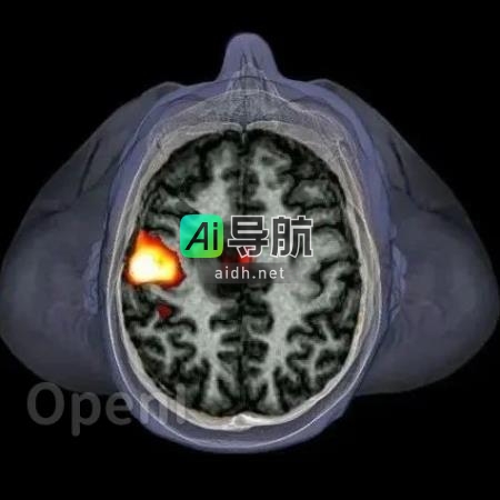 神经元活动尽在眼前：fMRI技术使大脑成像更快更精细 | 《自然》长文